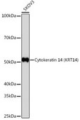 Anti-Cytokeratin 14 (KRT14) Antibody, clone 5Z4O9, Rabbit Monoclonal