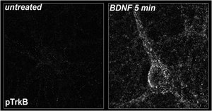 抗-磷酸-TrkB（Tyr816）抗体 from rabbit, purified by affinity chromatography