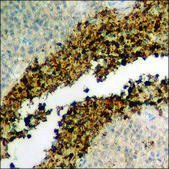 Anti-phospho-MEF2D (pSer444) antibody produced in rabbit affinity isolated antibody