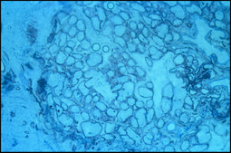 Monoclonal Anti-S-100 (β-Subunit) antibody produced in mouse clone SH-B1, ascites fluid