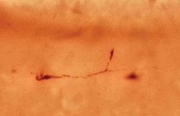 Anti-Reelin Antibody, a.a. 164-189 mreelin, clone 142 clone 142, Chemicon®, from mouse