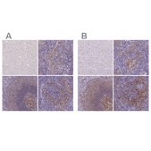 Anti-CD40 antibody produced in rabbit Prestige Antibodies® Powered by Atlas Antibodies, affinity isolated antibody, buffered aqueous glycerol solution