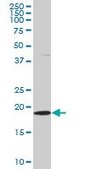 Monoclonal Anti-SKP1A, (C-terminal) antibody produced in mouse clone 2E6, purified immunoglobulin, buffered aqueous solution
