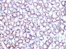 Anti-ATP1B1 antibody produced in rabbit