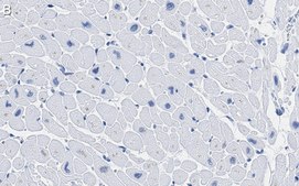 Anti-CACNA1C Antibody, clone 1F20 ZooMAb® Rabbit Monoclonal recombinant, expressed in HEK 293 cells