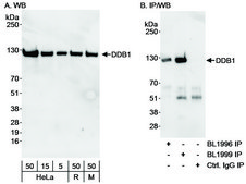 Rabbit anti-DDB1 Antibody, Affinity Purified Powered by Bethyl Laboratories, Inc.