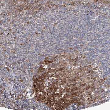 Anti-NCAPD2 antibody produced in rabbit Prestige Antibodies® Powered by Atlas Antibodies, affinity isolated antibody, buffered aqueous glycerol solution