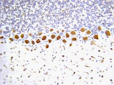 Anti-Nitrotyrosine Antibody Chemicon®, from rabbit