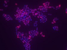 Enterococcus faecium FISH probe - Cy3 Probe for fluorescence in situ hybridization (FISH), 20µM in water