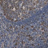 Anti-PPP2R1B antibody produced in rabbit Prestige Antibodies® Powered by Atlas Antibodies, affinity isolated antibody, buffered aqueous glycerol solution