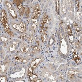 Anti-C3 antibody produced in rabbit Prestige Antibodies® Powered by Atlas Antibodies, affinity isolated antibody, buffered aqueous glycerol solution
