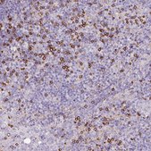 Anti-CD8A antibody produced in rabbit Prestige Antibodies® Powered by Atlas Antibodies, affinity isolated antibody, buffered aqueous glycerol solution