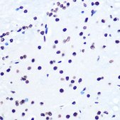 Anti-Histone H2AX antibody produced in rabbit