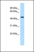 Anti-CUGBP1, (N-terminal) antibody produced in rabbit affinity isolated antibody