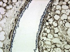 Anti-Collagen Type IV Antibody Chemicon®, from goat