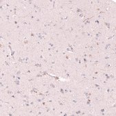 Anti-SLC18A2 antibody produced in mouse Prestige Antibodies® Powered by Atlas Antibodies, clone CL13157, purified by using Protein A, buffered aqueous glycerol solution