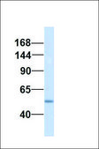 Anti-ABCC3 affinity isolated antibody