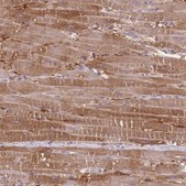 抗-PRKAR1A 兔抗 Prestige Antibodies® Powered by Atlas Antibodies, affinity isolated antibody, buffered aqueous glycerol solution