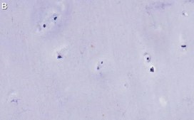 Anti-Aggrecan Antibody, clone 4B10 ZooMAb® Rabbit Monoclonal recombinant, expressed in HEK 293 cells