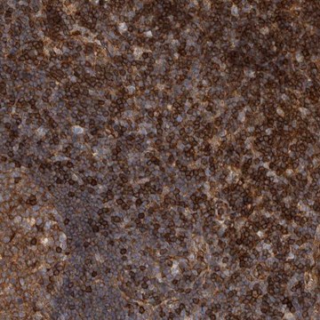 Anti-PRKCH antibody produced in rabbit Prestige Antibodies® Powered by Atlas Antibodies, affinity isolated antibody, buffered aqueous glycerol solution