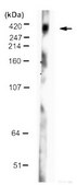 Anti-Huntingtin Antibody, a.a. 1-82 ascites fluid, clone 2B4, Chemicon®