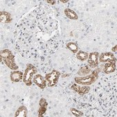 Anti-MUC1 antibody produced in rabbit Prestige Antibodies® Powered by Atlas Antibodies, affinity isolated antibody, buffered aqueous glycerol solution