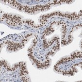 Anti-BUB3 antibody produced in rabbit Prestige Antibodies® Powered by Atlas Antibodies, affinity isolated antibody, buffered aqueous glycerol solution