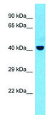 Anti-TSG101 (N-terminal) antibody produced in rabbit affinity isolated antibody