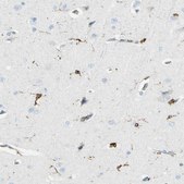 Anti-CD74 antibody produced in rabbit Prestige Antibodies® Powered by Atlas Antibodies, affinity isolated antibody, buffered aqueous glycerol solution