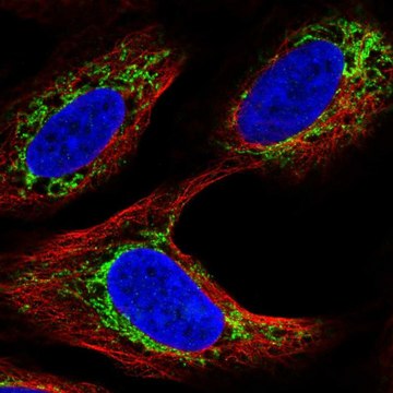 Anti-AR antibody produced in rabbit Prestige Antibodies® Powered by Atlas Antibodies, affinity isolated antibody