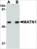 Anti-MATN1 antibody produced in rabbit affinity isolated antibody, buffered aqueous solution, ab1