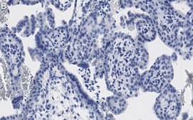 Anti-ATG7 Antibody, clone 1E15 ZooMAb® Rabbit Monoclonal recombinant, expressed in HEK 293 cells