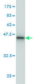 Monoclonal Anti-VHL antibody produced in mouse clone 1G12, purified immunoglobulin, buffered aqueous solution