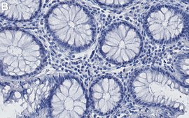 Anti-Phospho-c-Jun (Ser73) Antibody, clone 2B14 ZooMAb® Rabbit Monoclonal recombinant, expressed in HEK 293 cells