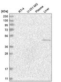 Anti-NR6A1 antibody produced in rabbit Prestige Antibodies® Powered by Atlas Antibodies, affinity isolated antibody