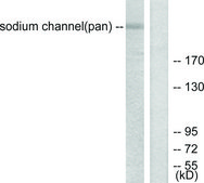Anti-SODIUM CHANNEL-PAN antibody produced in rabbit affinity isolated antibody