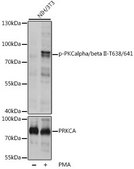Anti-Phospho-PKCalpha/beta II-T638/641 antibody produced in rabbit
