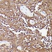 Anti-CDKN2A/p16INK4a antibody produced in mouse