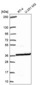 Anti-RPL5 antibody produced in rabbit Prestige Antibodies® Powered by Atlas Antibodies, affinity isolated antibody