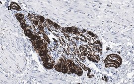 Anti-Peripherin Antibody, clone 1D4, ZooMAb® Rabbit Monoclonal recombinant, expressed in HEK 293 cells