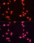 Anti-S100B antibody produced in rabbit