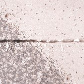 Monoclonal Anti-Smarcb1 Antibody Produced In Mouse Prestige Antibodies® Powered by Atlas Antibodies, clone CL14017, affinity isolated antibody, buffered aqueous glycerol solution