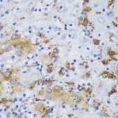 Anti-GSK3B antibody produced in rabbit