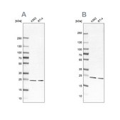 Anti-PSMB1 antibody produced in rabbit affinity isolated antibody, buffered aqueous glycerol solution, ab1