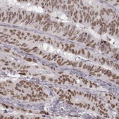Monoclonal Anti-SNAI1 antibody produced in mouse Prestige Antibodies® Powered by Atlas Antibodies, clone CL3700, purified immunoglobulin, buffered aqueous glycerol solution