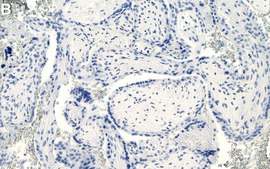 Anti-LIN28B Antibody, clone 1H17 ZooMAb® Rabbit Monoclonal recombinant, expressed in HEK 293 cells