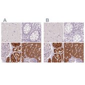 Anti-FTCD antibody produced in rabbit Prestige Antibodies® Powered by Atlas Antibodies, affinity isolated antibody, buffered aqueous glycerol solution