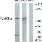 抗-CAMK2 兔抗 affinity isolated antibody
