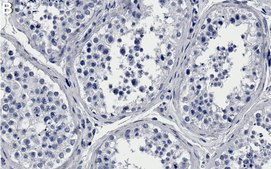 Anti-CBP Antibody, clone 3N20 ZooMAb® Rabbit Monoclonal recombinant, expressed in HEK 293 cells