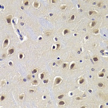 Anti-CDKN1B antibody produced in rabbit